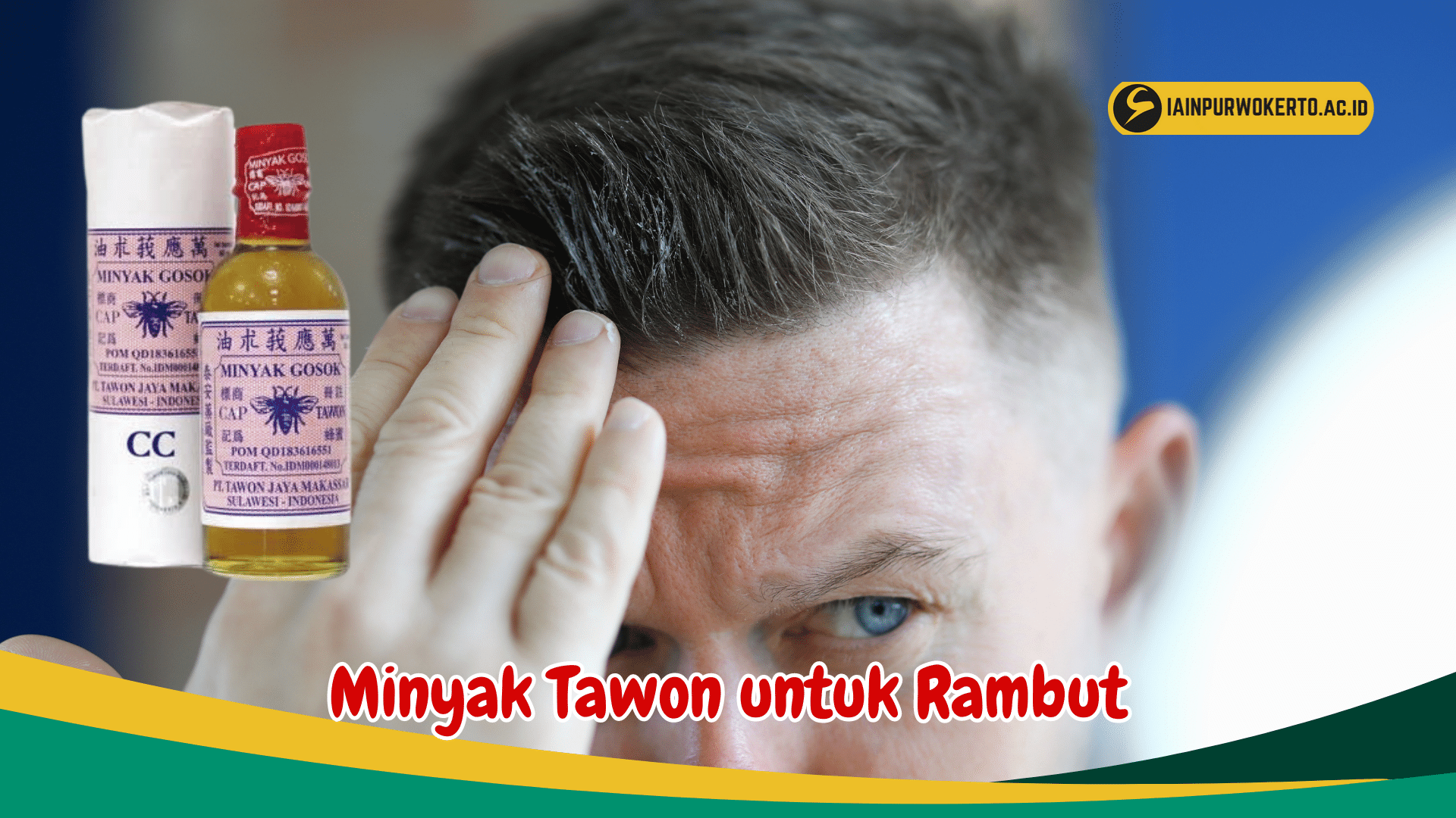 Manfaat Minyak Tawon untuk Menghilangkan Ketombe Manfaat Minyak Tawon untuk Menghilangkan Ketombe