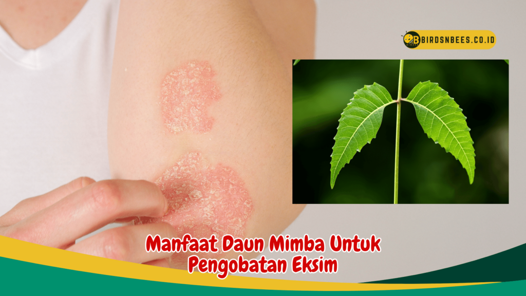 Manfaat Daun Mimba Untuk Pengobatan Eksim Manfaat Daun Mimba Untuk Pengobatan Eksim