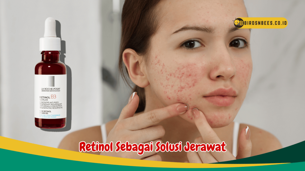 Retinol Sebagai Solusi Jerawat Retinol Sebagai Solusi Jerawat