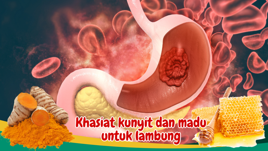 Khasiat kunyit dan madu untuk lambung Khasiat kunyit dan madu untuk lambung